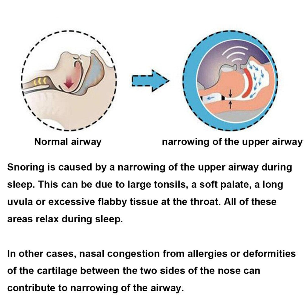 Silicone Anti Snoring Tongue Retaining Device Snore Sleep Solution Health Care