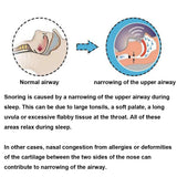 Silicone Anti Snoring Tongue Retaining Device Snore Sleep Solution Health Care