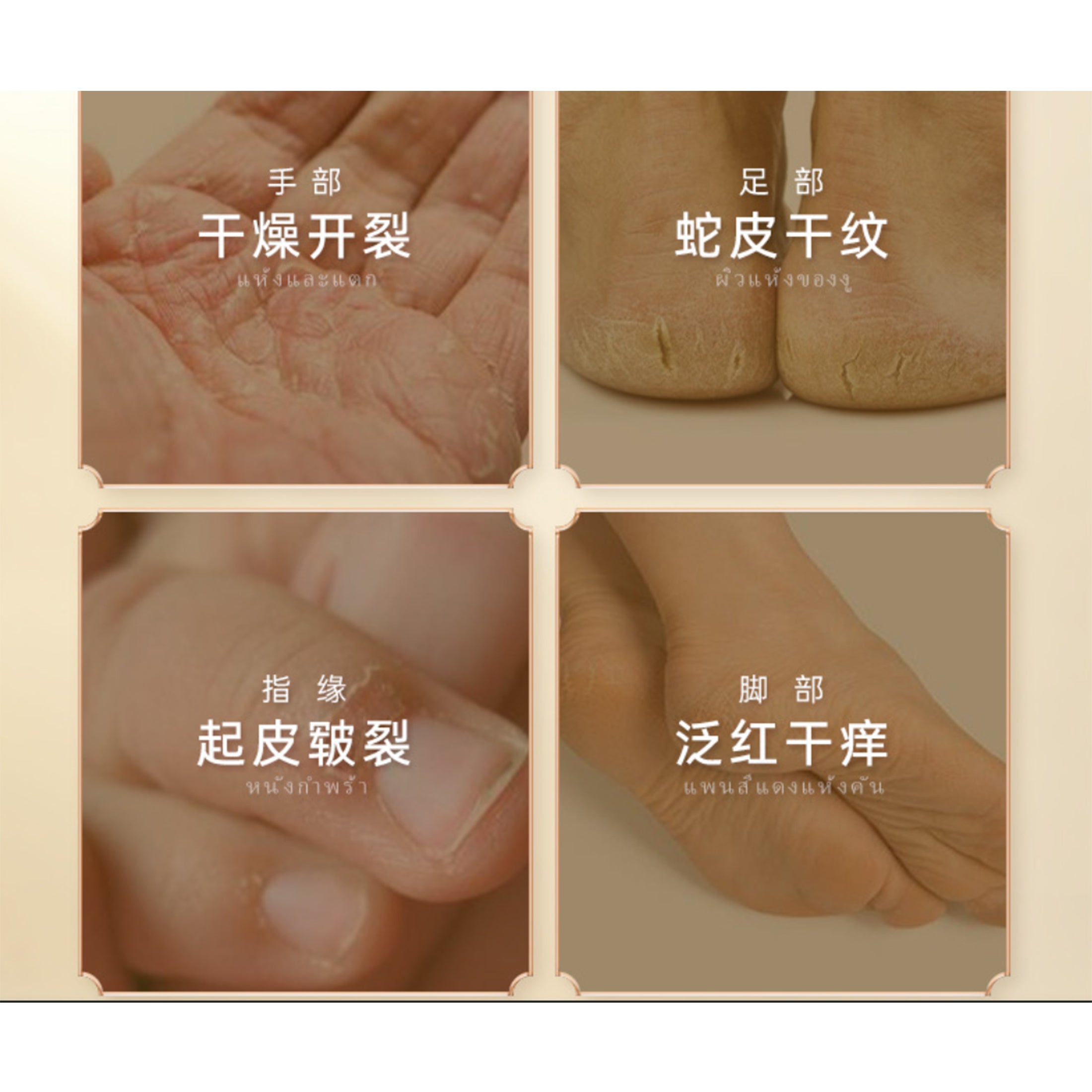 1 Box 20g Natural Banana Oil Anti-Drying Crack Foot Cream Heel Cracked Repair Cream Removal Dead Skin Hand Feet Care