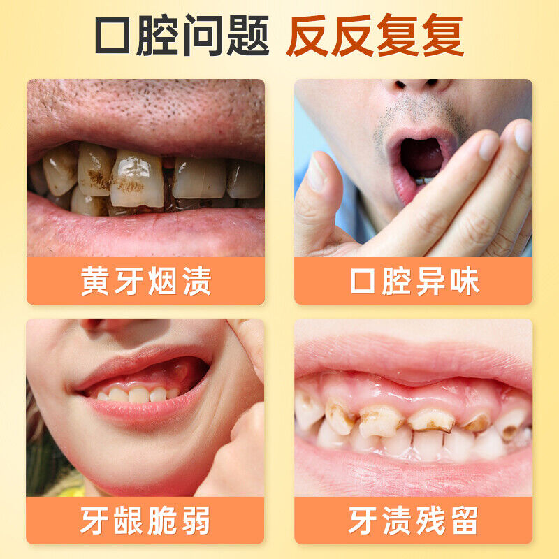 TongRenTang Probiotic Whitening Pearl Tooth Powder 同仁堂益生菌美白珍珠牙粉50g/罐*3pcs 亮齿洁牙粉