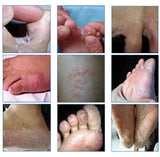 10pcs/lot  Fungal Infections Foot Bath Powder Feet Care Athlete's Foot, Foot Odor, Sweat, Itching, Peeling, Beriberi