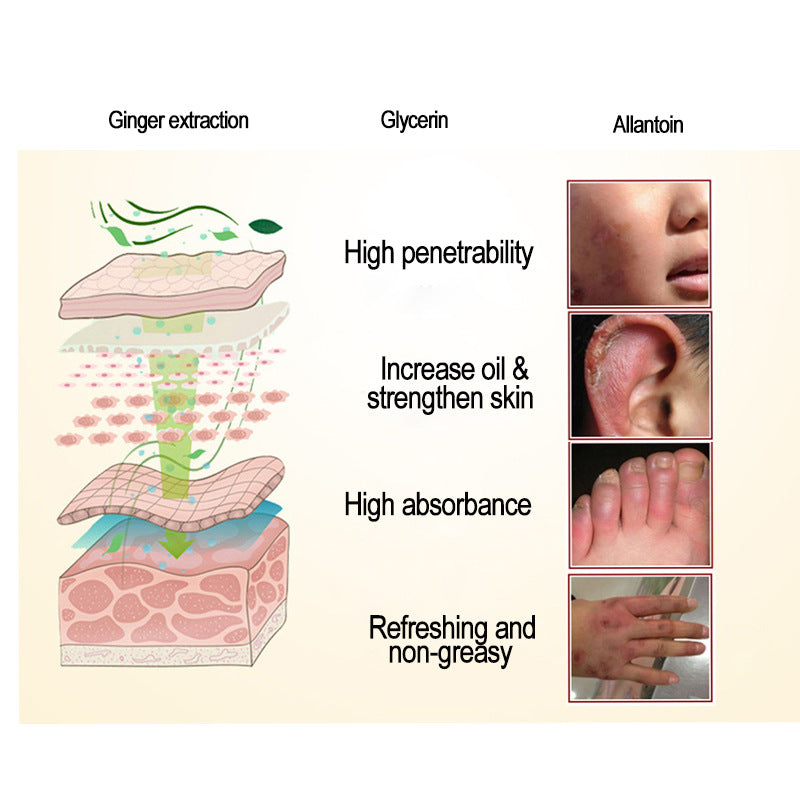 Anti Dry Crack Powerful Frozen Cracking Cream Prevent Repair Skin Dry Chapped Frozen Frostbite Chinese Medicinal Ointment