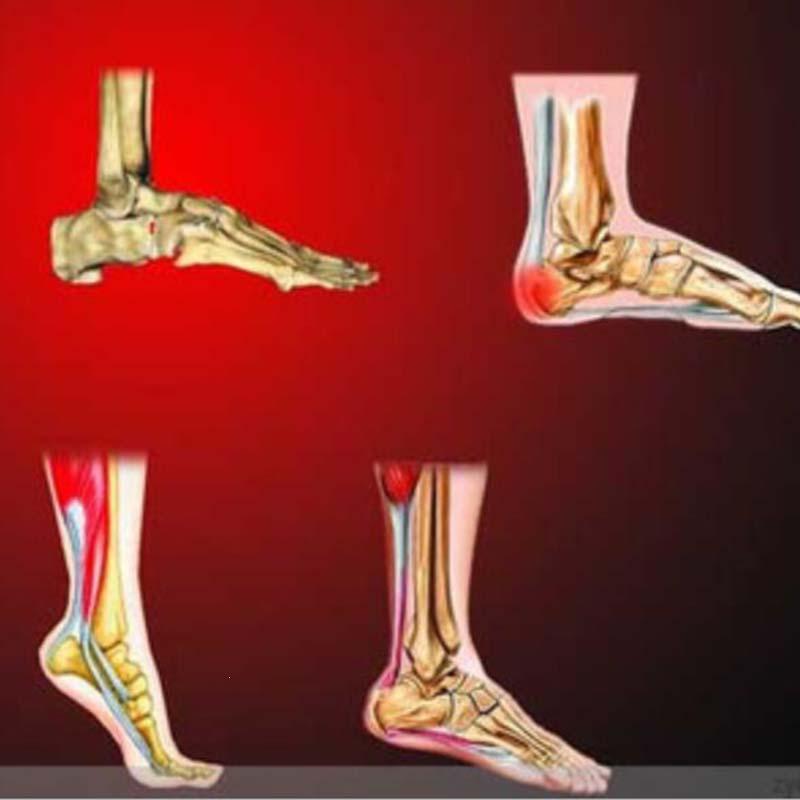 8pcs/bag Heel Pain Plaster Pain Relief Patch Herbal bone spurs achilles tendonitis Patch Foot Care Treatment Patches