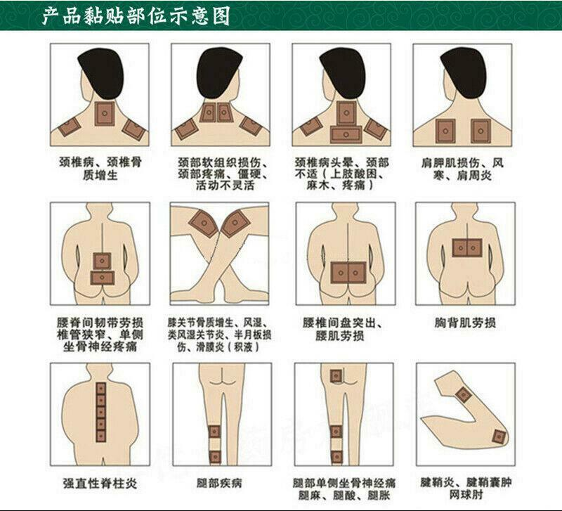 羚锐壮骨麝香止痛膏 50片 Ling Rui Zhuang Gu She Xiang Zhi Tong Gao 50 Pcs