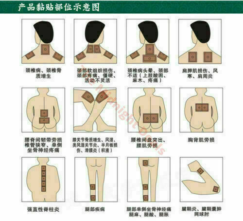 羚锐壮骨麝香止痛膏 10包(10片/包)LingRui Zhuang Gu She Xiang Zhi Tong Gao 10 Bags(10Pcs/Bag)