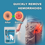 Natural Herbal Tea for Hemorrhoid Relief 100 Pure Herb Piles Discomfort Support