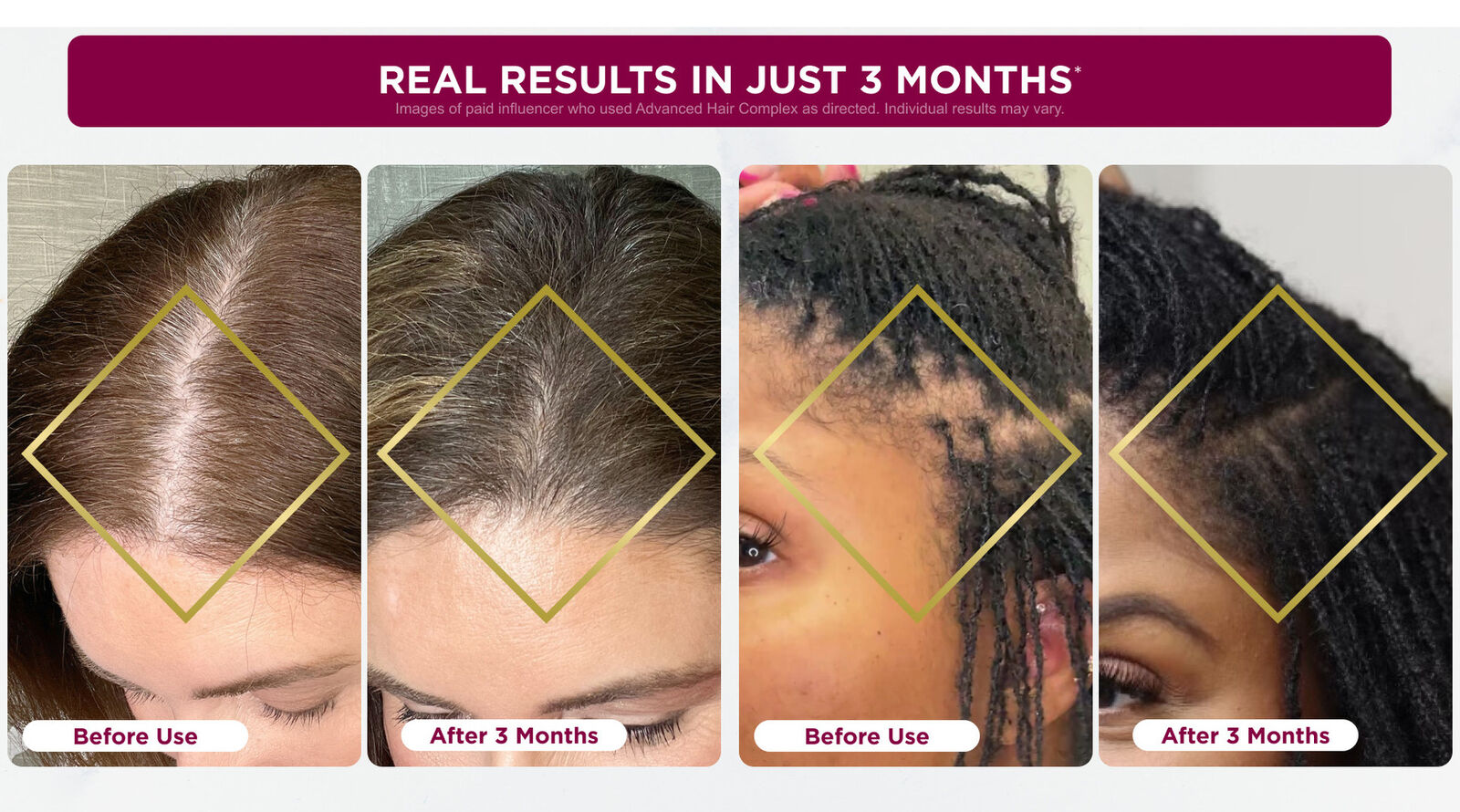 2bottles Hair Growth |Supports Growth of Thicker,Fuller Hair,60 Count