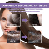 Follicle Dense Hair Drops Repair Follicles Hair Nourish Hair Root Thickening30ml