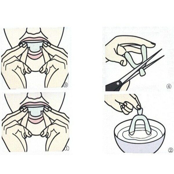 2Pairs Sleeping Mouth Guard Stop Teeth Grinding Anti Snoring Bruxism Eliminates