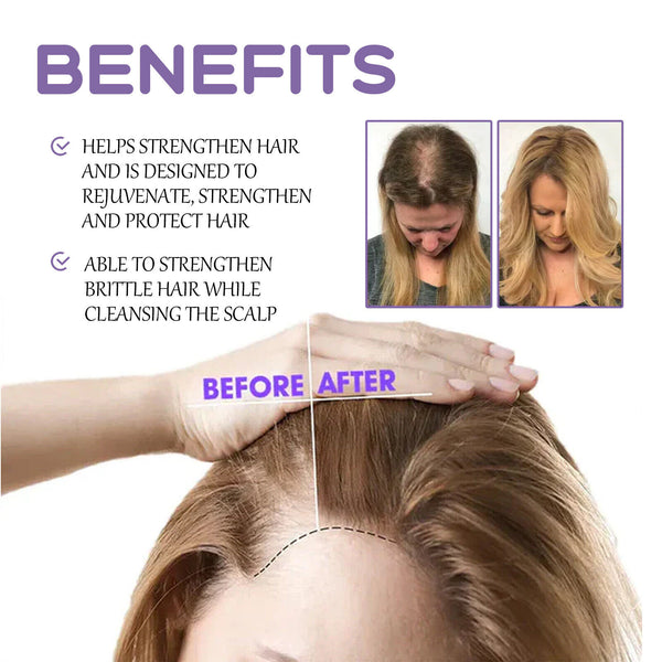 Follicle Dense Hair Drops Repair Follicles Hair Nourish Hair Root Thickening30ml