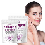 Multi Collagen Protein Powder, 2 Pounds – Type I,II,III,V,X with Biotin 10000...