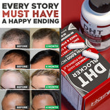 DHT Blocker Capsules Biotin 5000 MCG Hair Care 60 Capsules 30days Supply