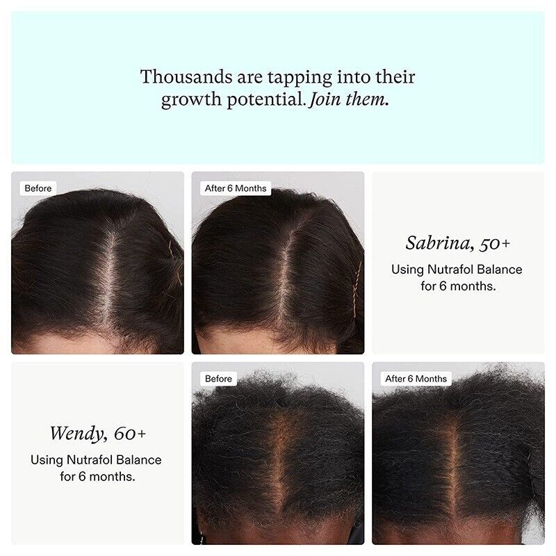 Women's Balance  Hair Growth Ages 45 and Up Hair Growth Supplements 120 Count Secondary image