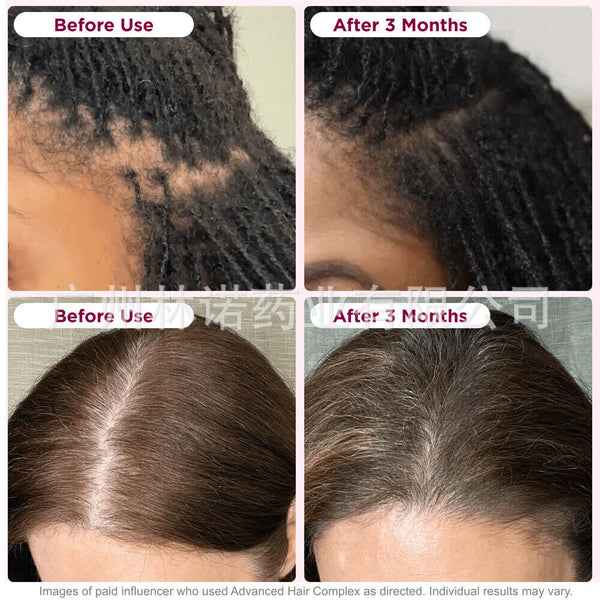 Hair Growth |Supports Growth of Thicker,Fuller Hair,60 Count 2bottles