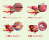 Herbal Removal Rot Myogenic Cream Bedsores Paste Treat Pressure Sores/Decubituses/Pressure Ulcer Festering Wound Healing 1PC