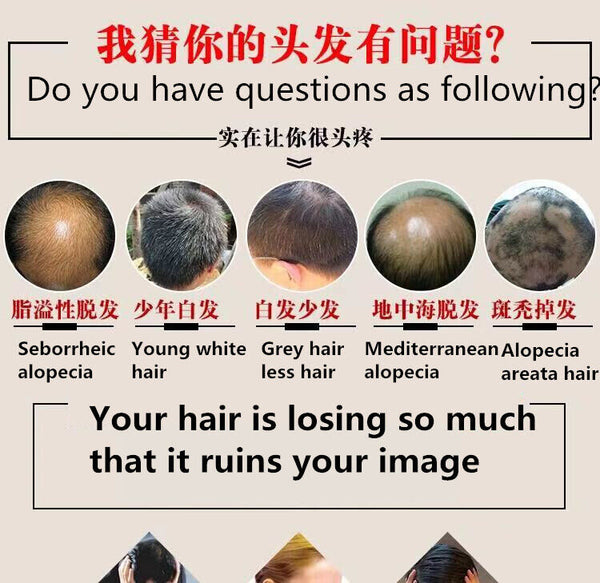 500g Prevent Hair Loss Herbal Pure Natural Chinese Troditional Hair Growth Herb