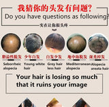 500g Prevent Hair Loss Herbal Pure Natural Chinese Troditional Hair Growth Herb