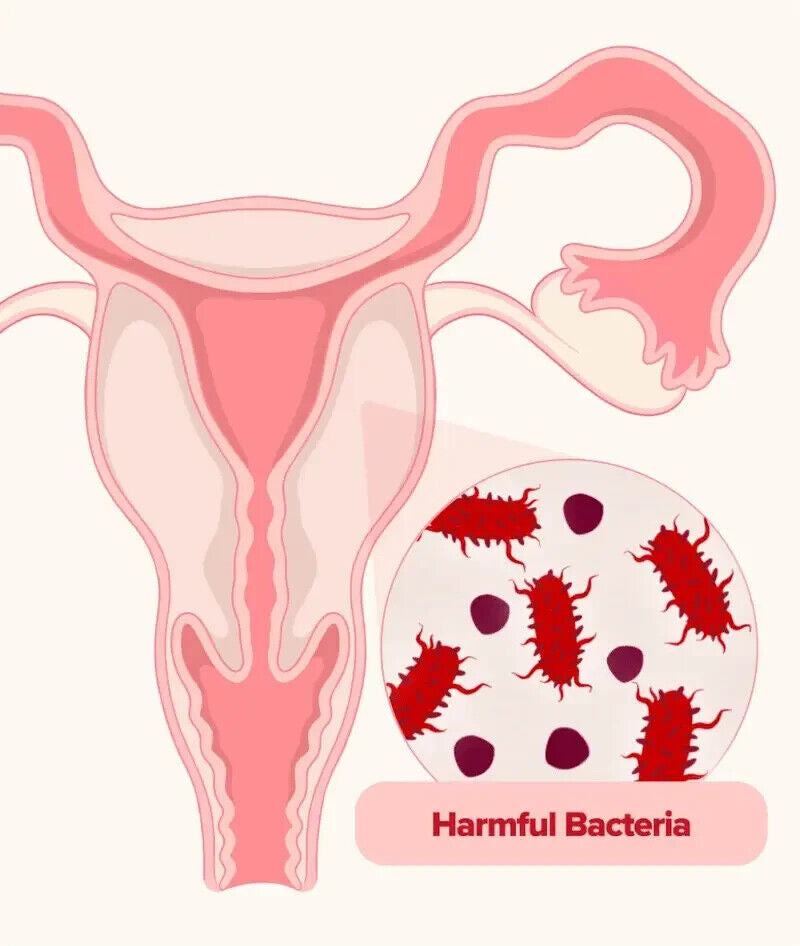 Vaginale Probiotika für Frauen pH Balance mit Prebiotika für Lactobacillus, New