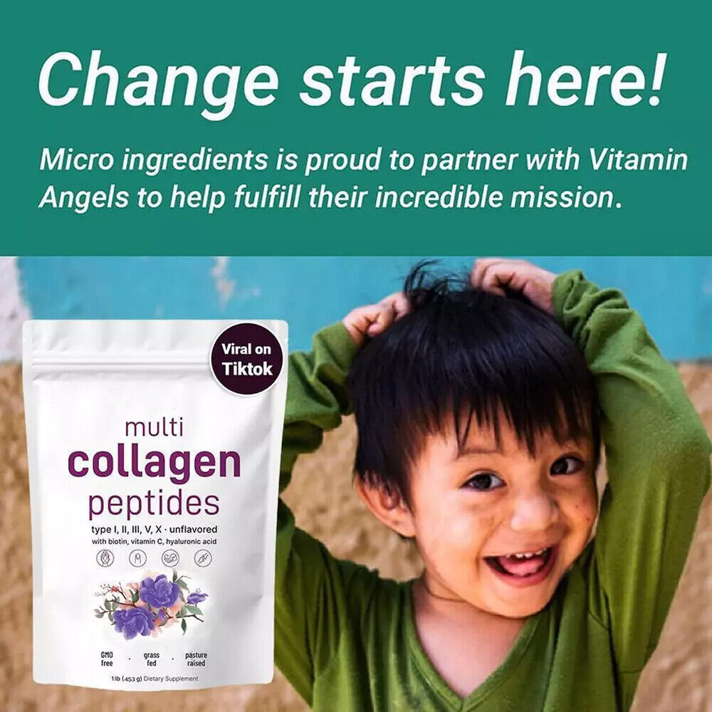 Multi Collagen Peptides Powder-Hydrolyzed Protein Peptides (Type I,II,III,V,X)