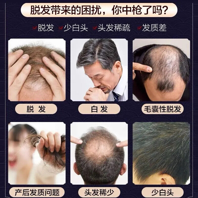 500g Prevent Hair Loss Herbal Pure Natural Chinese Troditional Hair Growth Herb