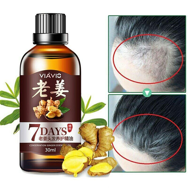 Hair Loss Prevention