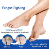 Nail Fungal Treatment Pen Antibacterial film Anti Fungus Infection Biological Repair Solution Nutritious Oil Nail Repair Pencil