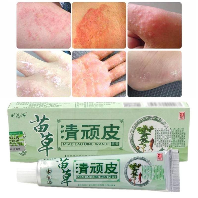 Chinese Herbal Medicine Skin Cream For Anti-itch Allergies Dermatitis Eczema Pruritus Psoriasis Ointment External Use Plaster Main image
