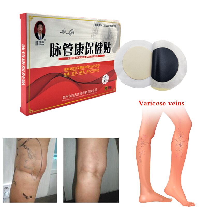 3pcs Spider Veins Varicose Treatment Plaster Varicose Veins Cure Patch Vasculitis Natural Solution Herbal Patches