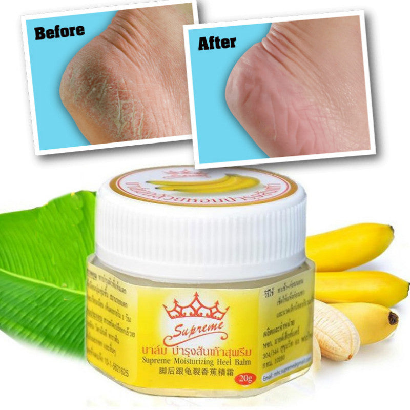 1 Box 20g Natural Banana Oil Anti-Drying Crack Foot Cream Heel Cracked Repair Cream Removal Dead Skin Hand Feet Care