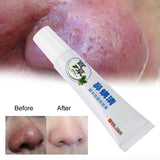 Nose Massage Tools Rosacea Treatment Cream Nose Redness Removal Cleaning Antibacterial Gel Skin Care Product