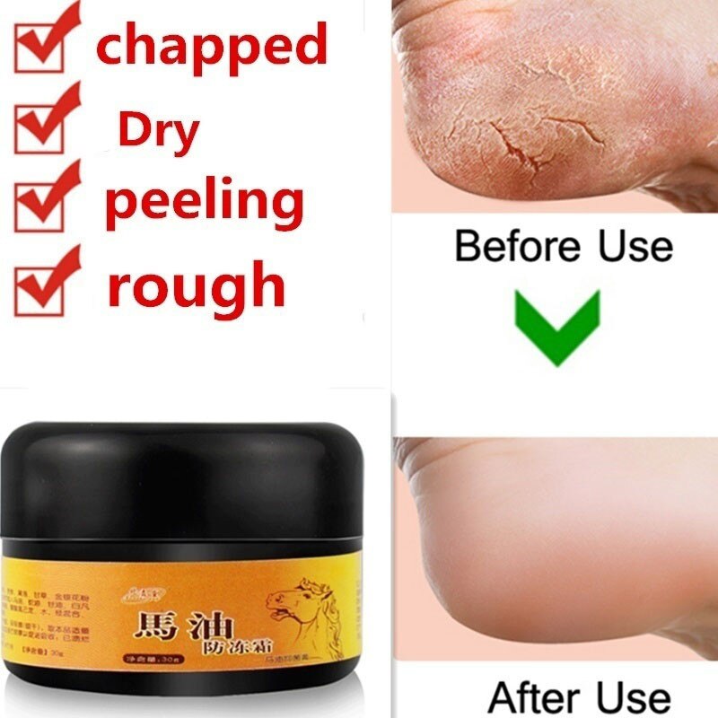 Horse Oil Foot Hand Antifreeze Cream Treatment Dry Skin Heel Chapped Peeling Repair Anti Chapping Wrinkle Treatment Ointment Main image