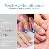 Nail Fungal Treatment Pen Antibacterial film Anti Fungus Infection Biological Repair Solution Nutritious Oil Nail Repair Pencil