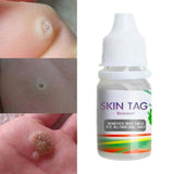 10ML Body Warts Treatment Cream Skin Tag Remover Foot Corn Removal Plantar Genital Warts Ointment Foot Care Cream Dropshopping