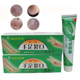 Plantar Crack Care Cream 100% Herbal Hand Foot Skin Splitting Cure Hydrating Ointment Chinese Medicine Cleft Treatment Plaster