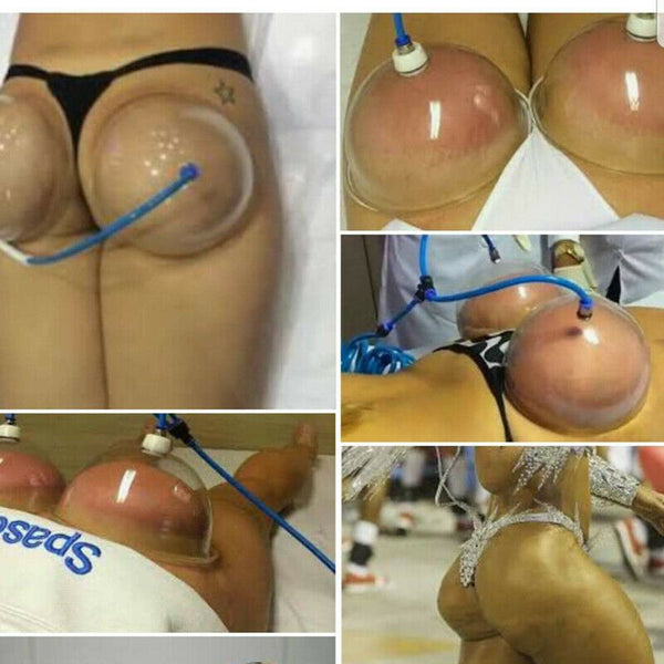 Breast & Buttocks Enhancement Pump Lifting Vacuum Suction Cupping Suction Therapy Device
