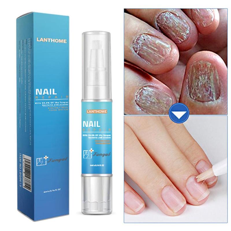 Nail Fungal Treatment Pen Antibacterial film Anti Fungus Infection Biological Repair Solution Nutritious Oil Nail Repair Pencil Main image
