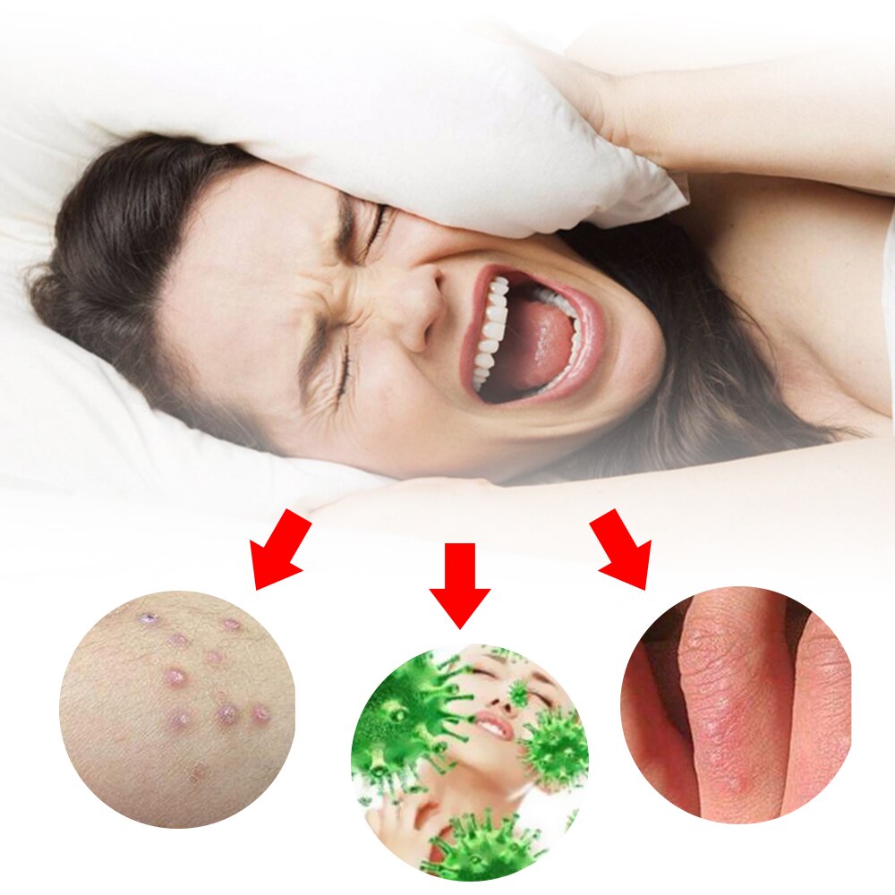 1Pcs Anti-itch Cream Pain Removal Eczema Psoriasis Ointment Dermatitis Chinese Herbal Medical Plaster Health Care Secondary image