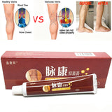 Chinese Natural Herbal Medicine for Varicose Veins Ointment Vasculitis Inflammation Leg Massage Varicose Veins Cream