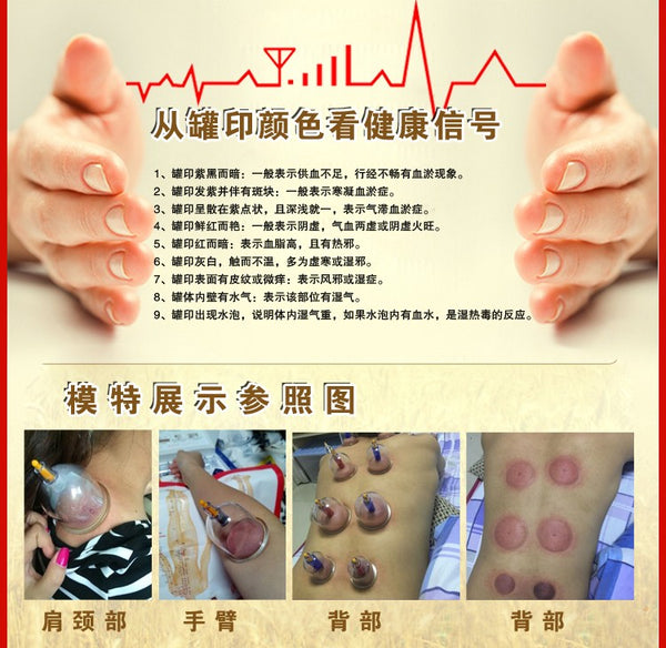 Cheap 32 Pieces Cans cups chinese vacuum cupping kit pull out a vacuum apparatus therapy relax massagers curve suction pumps