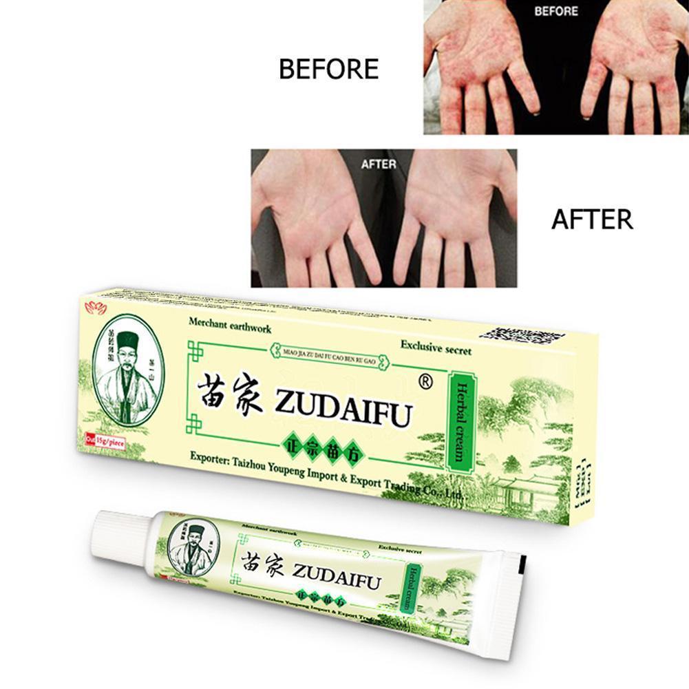 Zudaifu Cream Psoriasis Cream Skin Care Psoriasis Skin Dropshipping Dermatitis Eczematoid Eczema Ointment Treatment Care Cream