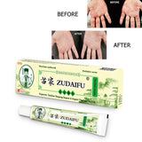 Zudaifu Cream Psoriasis Cream Skin Care Psoriasis Skin Dropshipping Dermatitis Eczematoid Eczema Ointment Treatment Care Cream