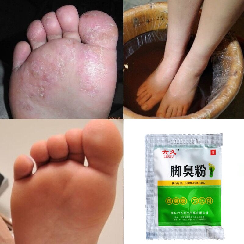 10pcs/lot  Fungal Infections Foot Bath Powder Feet Care Athlete's Foot, Foot Odor, Sweat, Itching, Peeling, Beriberi Secondary image