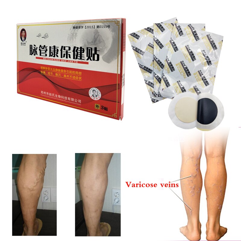 3pcs Spider Veins Varicose Treatment Plaster Varicose Veins Cure Patch Vasculitis Natural Solution Herbal Patches