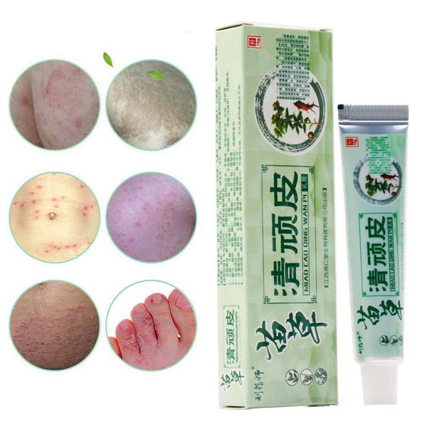 Health psoriasis treatment cream Skin care Dermatitis Eczematoid Eczema Ointment eczema cream psoriasis Itching relief Ointment