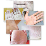 Natural Banana Oil Anti-Drying Crack Foot Cream Heel Cracked Repair Cream Removal Dead Skin Hand Feet Care 1 Box 20g