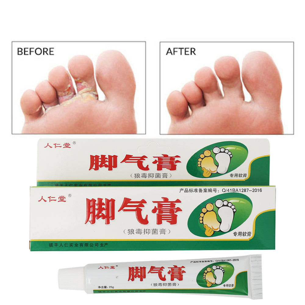 Relieve Beriberi Cream Foot Care Chinese Herbal Patch Anti Fungal Infection Feet Repair Herbal Beriberi Treatment Cream