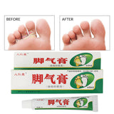 Relieve Beriberi Cream Foot Care Chinese Herbal Patch Anti Fungal Infection Feet Repair Herbal Beriberi Treatment Cream