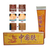 Natural Chinese Medicine Herbal Anti Bacteria Cream Psoriasis Eczema Ointment Skin Problem Repair Treatment Health Care 15g