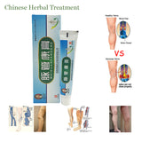 Varicose Veins ointment eins Varicose Treatment Plaster Varicose Veins Cure Patch Vasculitis Natural Solution Herbal Patches