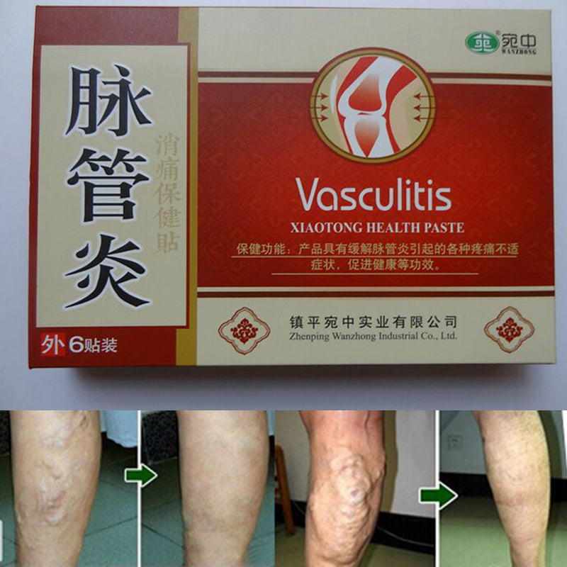 Spider Veins Varicose Treatment Plaster Varicose Veins Cure Patch Vasculitis Natural Solution Herbal Patches 24 Pcs Main image